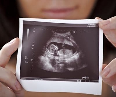 Schwangerschaft Ultraschall Untersuchung
